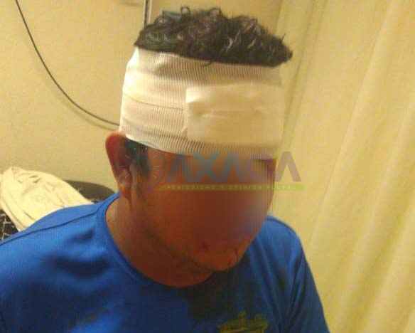 Porros de la UABJO golpean a trabajador al interior de CU