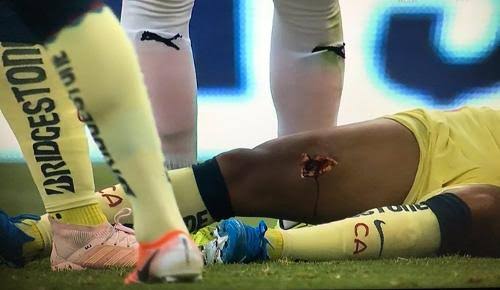 Gio Dos Santos sufre escalofriante lesión en el Clásico Nacional