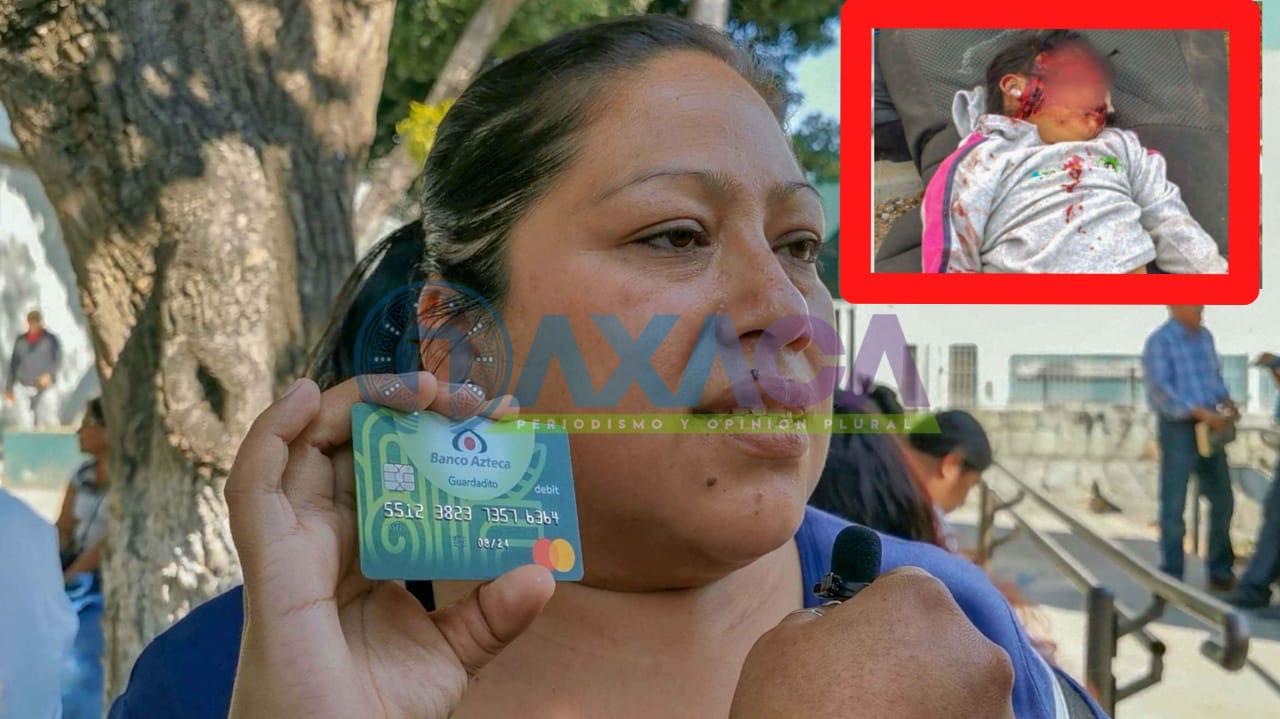 Piden apoyo para mujeres lesionadas en el choque de Ocotlán, Oaxaca