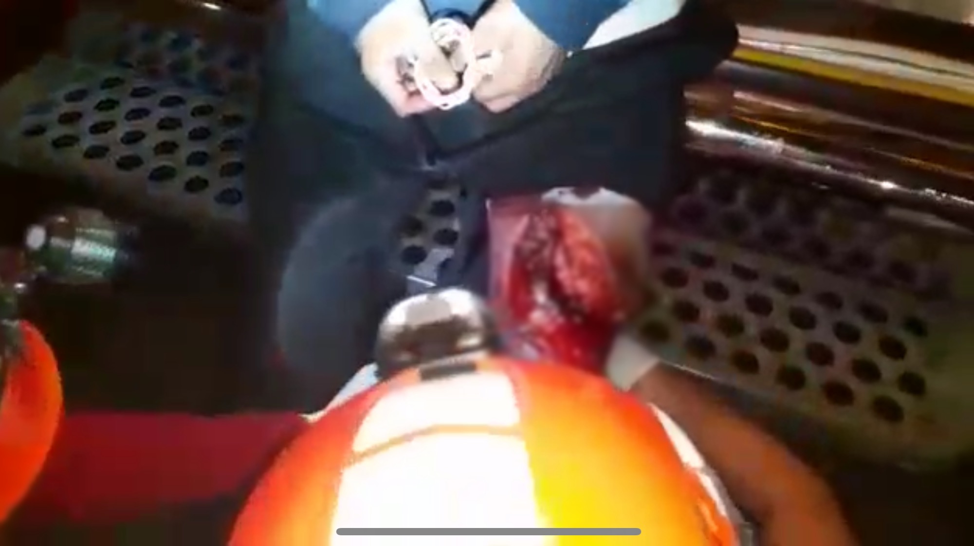 Choque deja fuerte lesión de motociclista en Xoxocotlán, Oaxaca