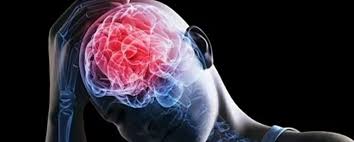 Covid-19 genera posible daño cerebral