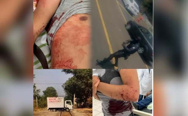 Por no detenerse en un cerco sanitario policías abren fuego contra normalistas