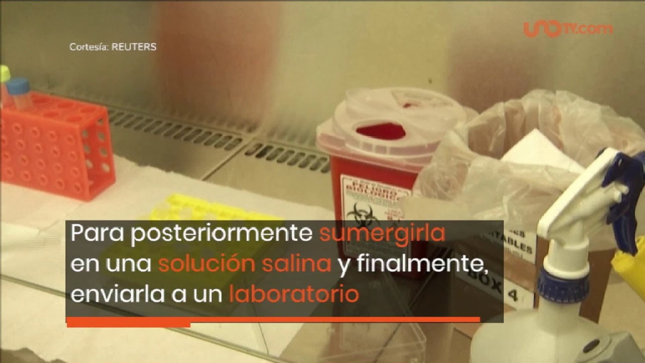 En EU es autorizado el nuevo kit de pruebas caseras de COVID-19.