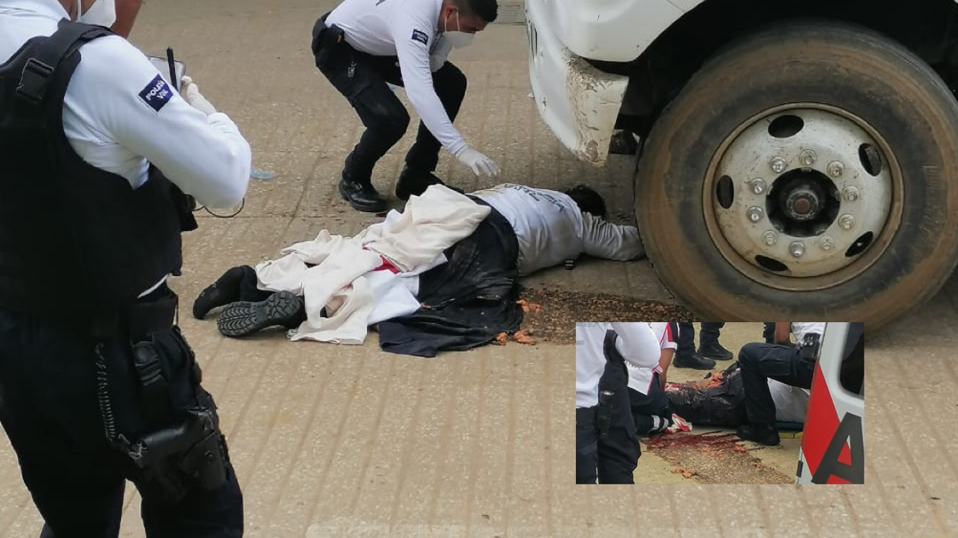 Atropellan y destrozan pierna de policía vial municipal en Santa Cruz Xoxocotlán