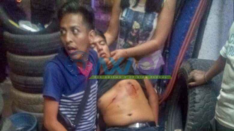 Balean a joven frente a panificadora San Martín