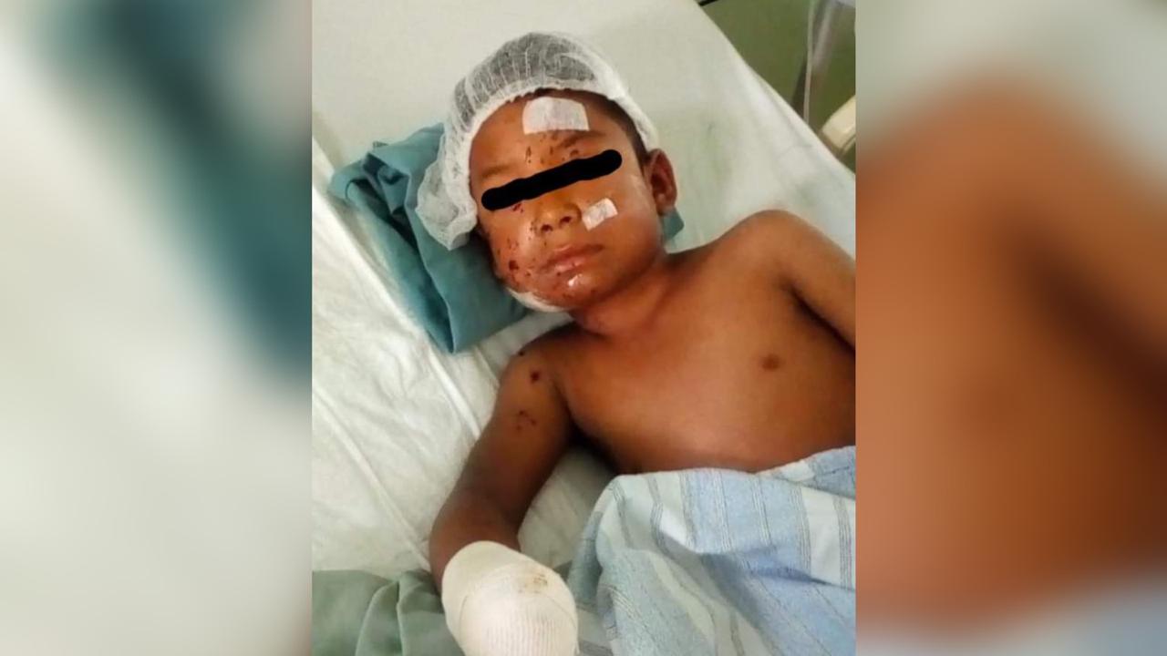 Menor pierde la mano al explotarle cohetón en Ocotlán, Oaxaca