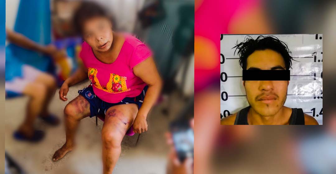 Oaxaca Feminicida: pierde la vida Carolina, víctima de brutal golpiza de su pareja en Juchitán, Oaxaca