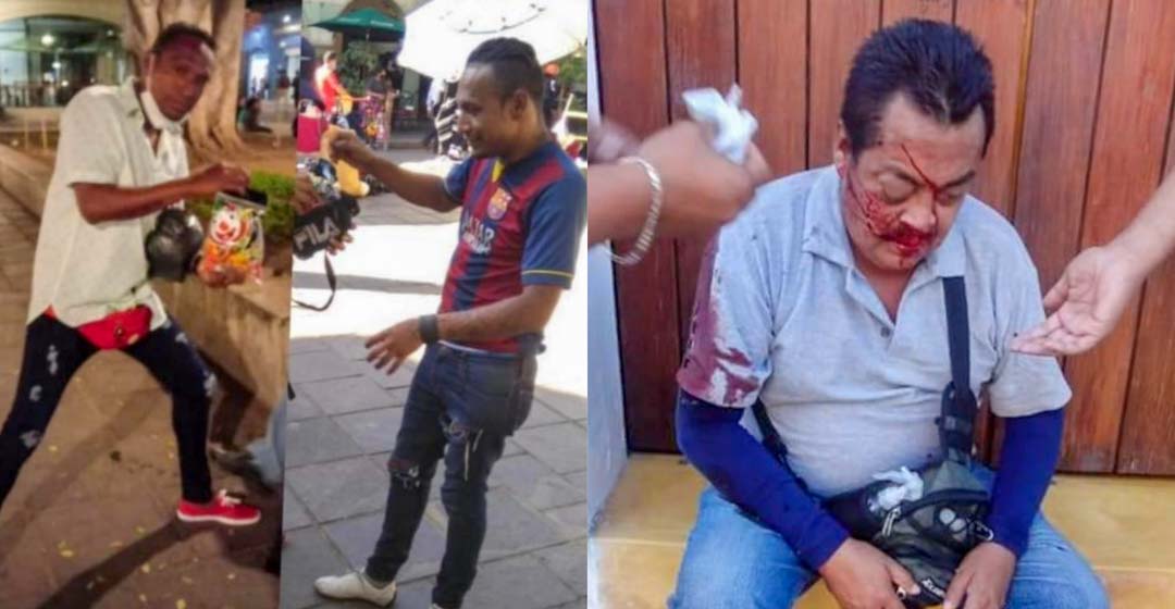 Tras agonizar tres días, pierde la vida inspector golpeado por vendedor ambulante