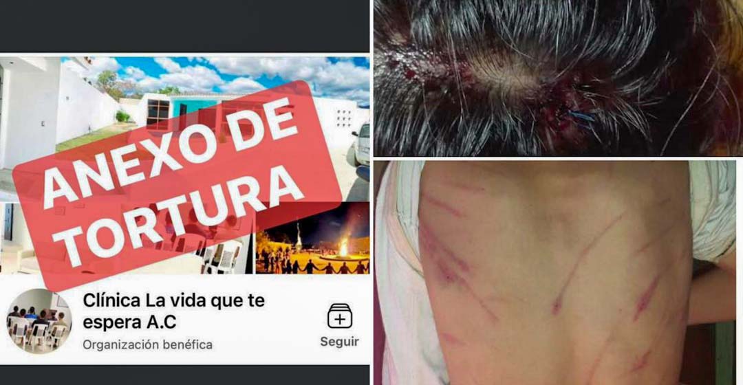 Seudo clínica de rehabilitación ‘La vida que te espera’ en Santiago Etla, es denunciado por tortura