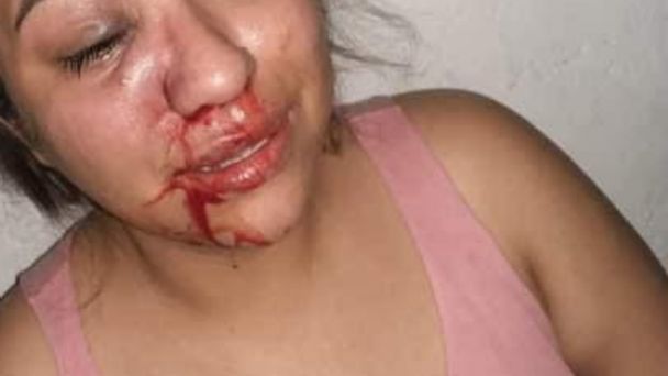 Temo por mi vida porque mi esposo se volvió mi agresor: denuncia Alina en redes