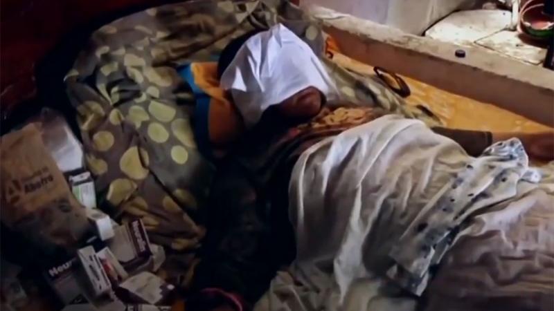 Queman a mujer con ácido; está a punto de perder los ojos