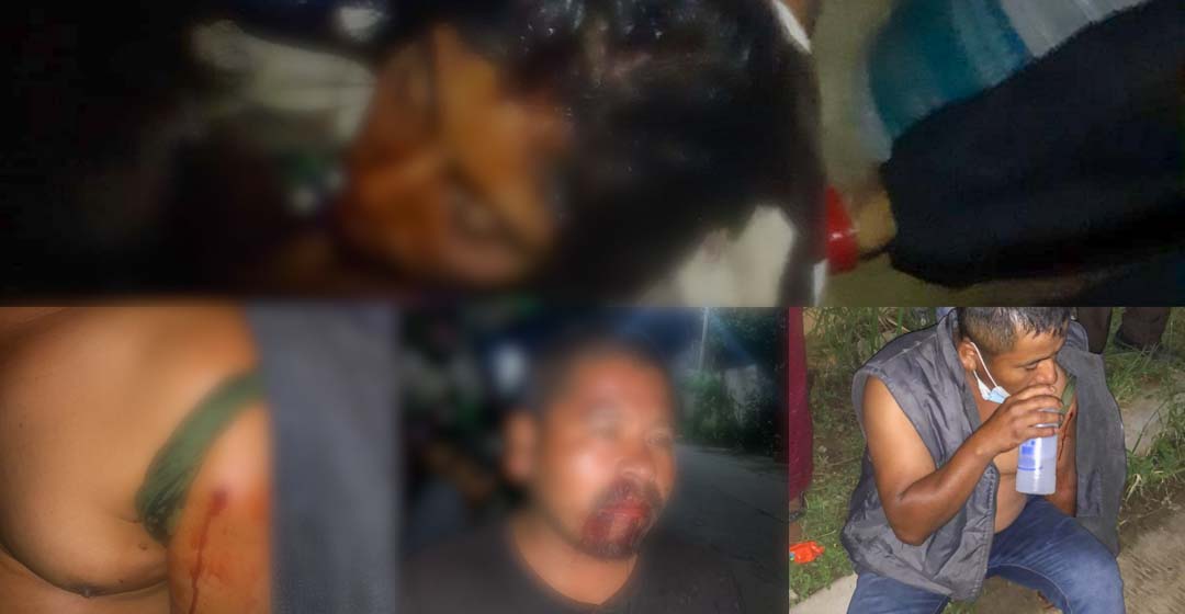 Enfrentamiento en Hacienda Blanca, Oaxaca, deja cuatro lesionados dos por arma de fuego