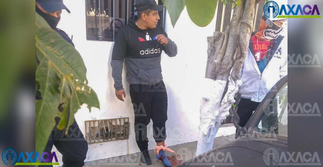 Disparan en el pie a motociclista en San Martín Mexicapan, Oaxaca