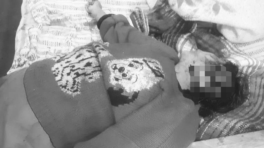 FOTOS: Desfiguran rostro de mujer y amputan mano con arma blanca, los hechos en región cañada, Oaxaca