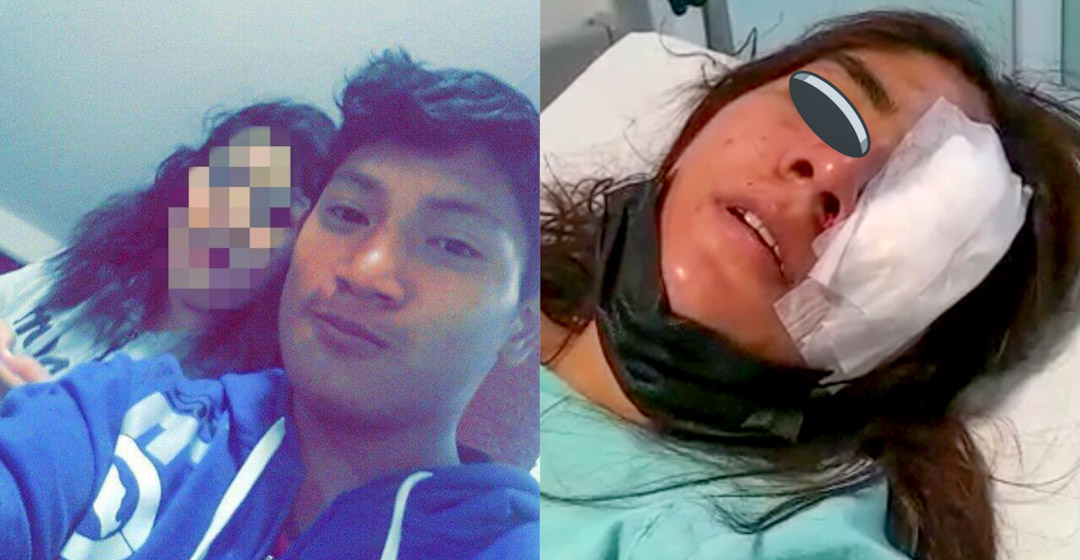 VIDEO: en un intento de feminicidio José Arista, atacó a su pareja Yoselín, quien puede perder su ojo