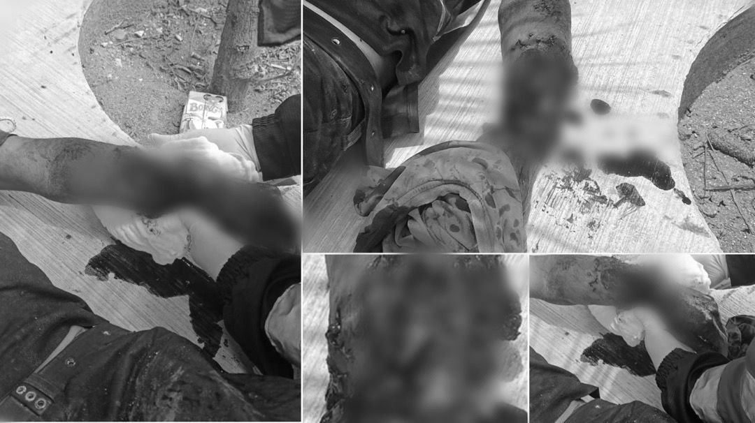 Perros pitbull devoran brazo de abuelito en Xoxocotlán; policías los sacrifican