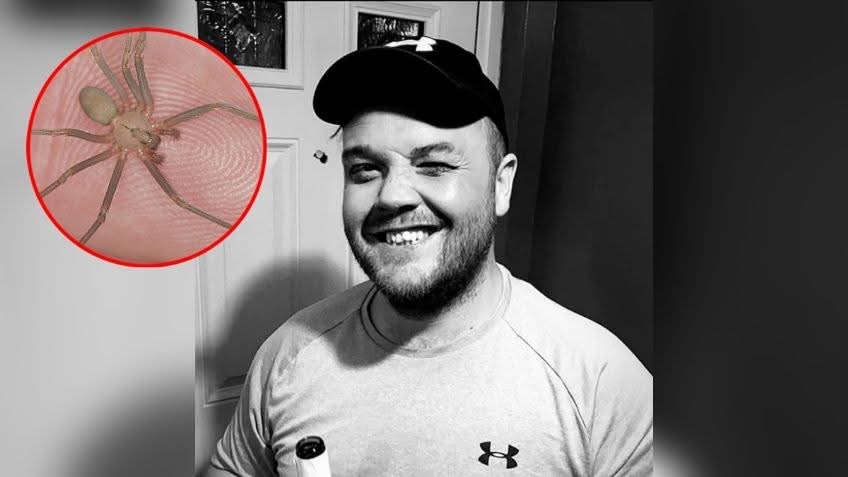 Muere hombre tras ser mordido por una araña venenosa que compró por internet